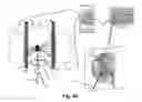 Fig. 15 - Tissue interventions using nuclear-emission image guidance