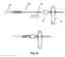 Fig. 18 - Tissue interventions using nuclear-emission image guidance