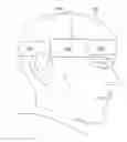 Fig. 01 - Ultrasound emitting device comprising a head frame