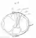 Fig. 27 - Ultrasound emitting device comprising a head frame