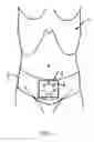 Fig. 02 - Method and an apparatus for recording bladder volume