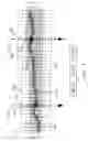 Fig. 10 - Apparatus and method for optimized search for displacement estimation in elasticity imaging