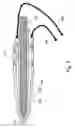 Fig. 10 - Method and apparatus for protecting the rectal wall during cryoablation