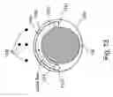 Fig. 21 - Method and apparatus for protecting the rectal wall during cryoablation