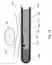 Fig. 26 - Method and apparatus for protecting the rectal wall during cryoablation