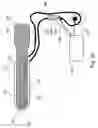 Fig. 05 - Method and apparatus for protecting the rectal wall during cryoablation