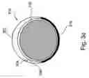 Fig. 07 - Method and apparatus for protecting the rectal wall during cryoablation