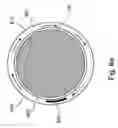 Fig. 11 - Method and apparatus for protecting the rectal wall during cryoablation