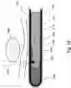 Fig. 26 - Method and apparatus for protecting the rectal wall during cryoablation