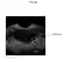 Fig. 09 - ULTRASOUND IMAGING SYSTEM FOR EXTRACTING VOLUME OF AN OBJECT FROM AN ULTRASOUND IMAGE AND METHOD FOR THE SAME
