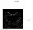 Fig. 10 - ULTRASOUND IMAGING SYSTEM FOR EXTRACTING VOLUME OF AN OBJECT FROM AN ULTRASOUND IMAGE AND METHOD FOR THE SAME
