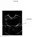 Fig. 13 - ULTRASOUND IMAGING SYSTEM FOR EXTRACTING VOLUME OF AN OBJECT FROM AN ULTRASOUND IMAGE AND METHOD FOR THE SAME
