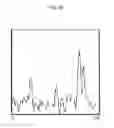 Fig. 14 - ULTRASOUND IMAGING SYSTEM FOR EXTRACTING VOLUME OF AN OBJECT FROM AN ULTRASOUND IMAGE AND METHOD FOR THE SAME