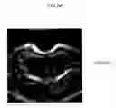 Fig. 15 - ULTRASOUND IMAGING SYSTEM FOR EXTRACTING VOLUME OF AN OBJECT FROM AN ULTRASOUND IMAGE AND METHOD FOR THE SAME
