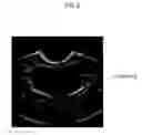 Fig. 17 - ULTRASOUND IMAGING SYSTEM FOR EXTRACTING VOLUME OF AN OBJECT FROM AN ULTRASOUND IMAGE AND METHOD FOR THE SAME