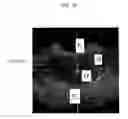 Fig. 18 - ULTRASOUND IMAGING SYSTEM FOR EXTRACTING VOLUME OF AN OBJECT FROM AN ULTRASOUND IMAGE AND METHOD FOR THE SAME
