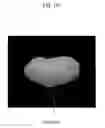Fig. 22 - ULTRASOUND IMAGING SYSTEM FOR EXTRACTING VOLUME OF AN OBJECT FROM AN ULTRASOUND IMAGE AND METHOD FOR THE SAME