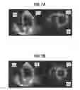 Fig. 08 - Real-time Elastic Registration to Determine Temporal Evolution of Internal Tissues for Image-Guided Interventions