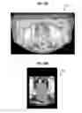 Fig. 11 - Real-time Elastic Registration to Determine Temporal Evolution of Internal Tissues for Image-Guided Interventions