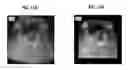 Fig. 13 - Real-time Elastic Registration to Determine Temporal Evolution of Internal Tissues for Image-Guided Interventions