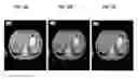 Fig. 14 - Real-time Elastic Registration to Determine Temporal Evolution of Internal Tissues for Image-Guided Interventions