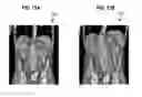 Fig. 15 - Real-time Elastic Registration to Determine Temporal Evolution of Internal Tissues for Image-Guided Interventions