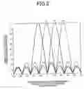 Fig. 04 - Doppler velocity detection device and ultrasonographic device using the same