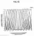 Fig. 11 - Doppler velocity detection device and ultrasonographic device using the same