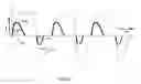 Fig. 08 - Method and system for enhancing spectral doppler presentation