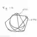 Fig. 03 - Methods and apparatuses for image guided medical procedures