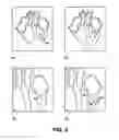 Fig. 07 - Methods and apparatuses for image guided medical procedures
