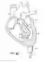 Fig. 20 - Methods and apparatuses for image guided medical procedures