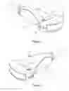 Fig. 02 - Structure for attaching needle guide to ultrasound probe