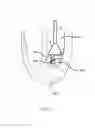 Fig. 19 - Tissue imaging and extraction systems