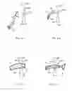 Fig. 21 - Tissue imaging and extraction systems