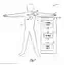 Fig. 02 - Implantable medical device sensing wireless ECG as substitute for intracardiac electrogram