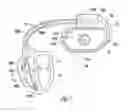 Fig. 03 - Implantable medical device sensing wireless ECG as substitute for intracardiac electrogram