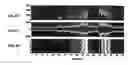 Fig. 06 - Microelectrode recording analysis and visualization for improved target localization