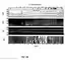 Fig. 09 - Microelectrode recording analysis and visualization for improved target localization