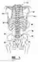 Fig. 02 - EMG diagnostic system and method