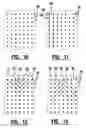Fig. 08 - EMG diagnostic system and method