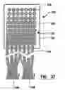 Fig. 27 - EMG diagnostic system and method