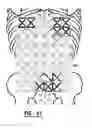 Fig. 40 - EMG diagnostic system and method