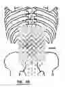 Fig. 41 - EMG diagnostic system and method