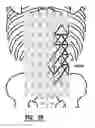 Fig. 42 - EMG diagnostic system and method