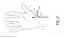 Fig. 03 - Cardiac output measurement devices and methods