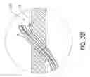 Fig. 05 - Cardiac output measurement devices and methods