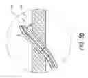 Fig. 05 - Cardiac output measurement devices and methods