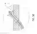 Fig. 05 - Cardiac output measurement devices and methods