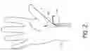 Fig. 03 - Cardiac output measurement devices and methods